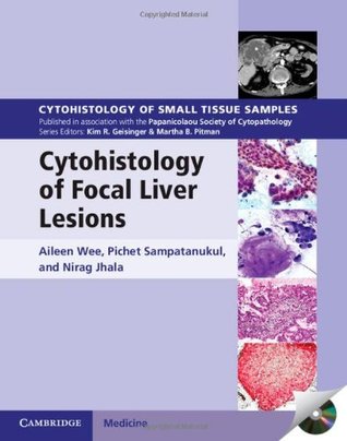 Full Download Cytohistology of Focal Liver Lesions (Cytohistology of Small Tissue Samples) - Aileen Wee | ePub
