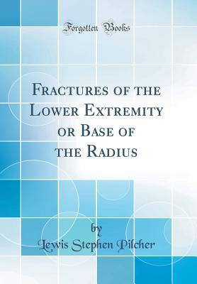 Read Online Fractures of the Lower Extremity or Base of the Radius (Classic Reprint) - Lewis Stephen Pilcher | PDF